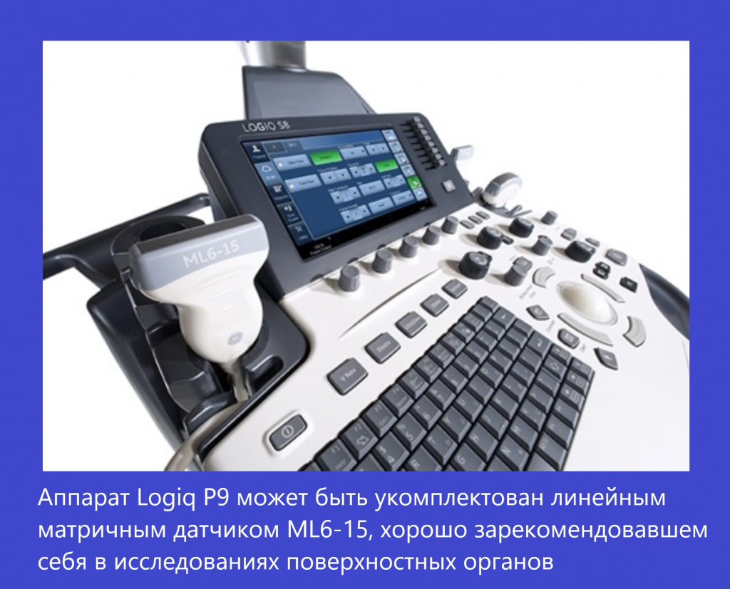 Logiq_P9_1.jpg Logiq_P9_1.jpg