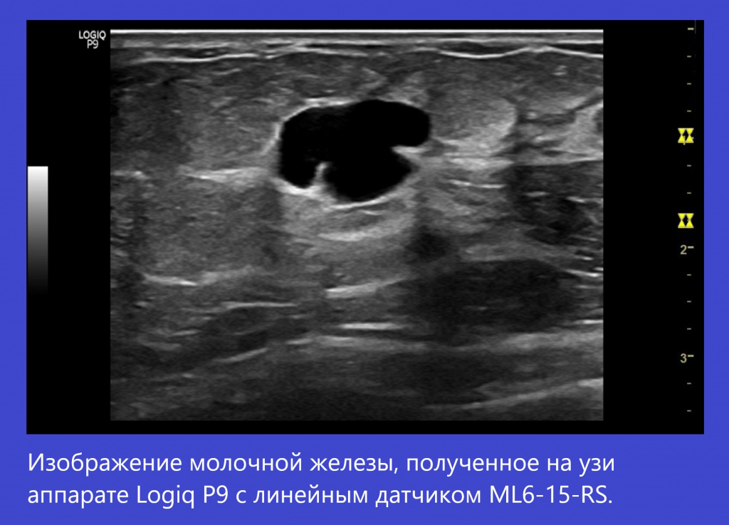 Logiq P9-3.jpg Logiq P9-3.jpg
