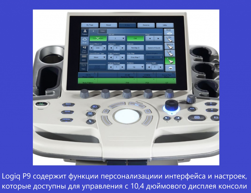Logiq_P9_4.jpg Logiq_P9_4.jpg